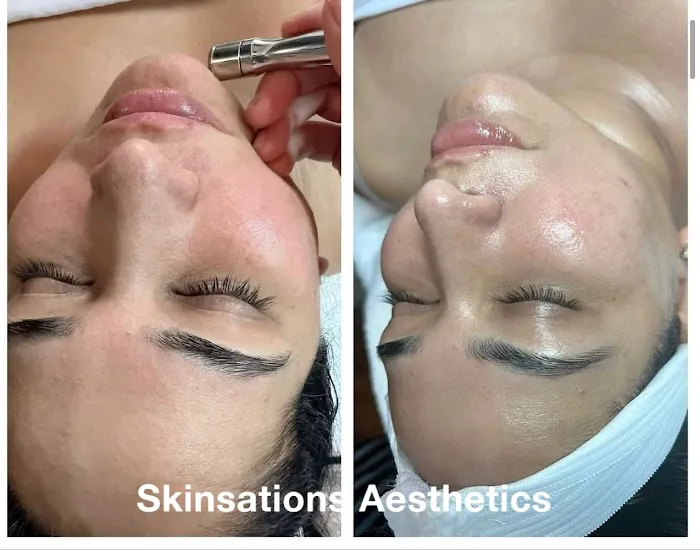 Skinsations Aesthetics Picture 1