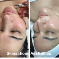 Skinsations Aesthetics ico