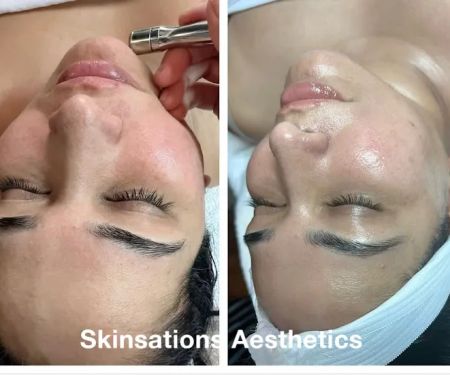 Skinsations Aesthetics