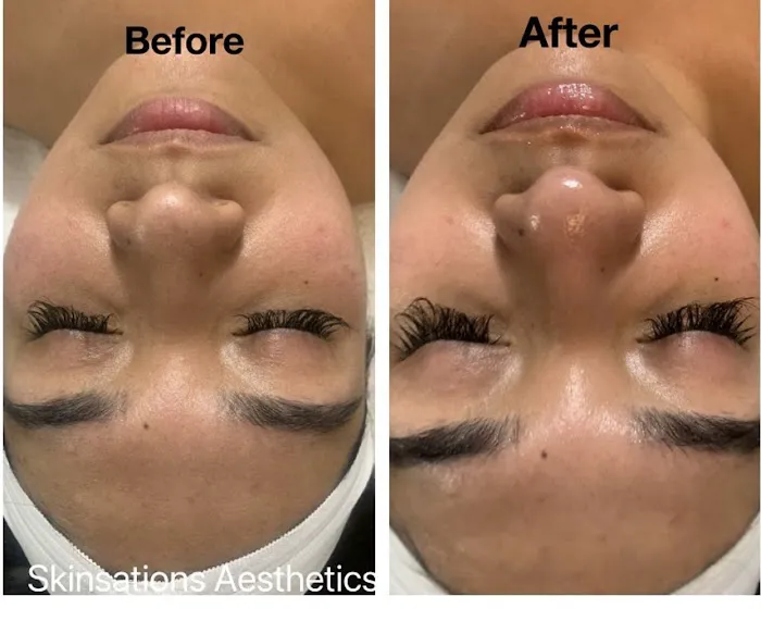 Skinsations Aesthetics Picture 4