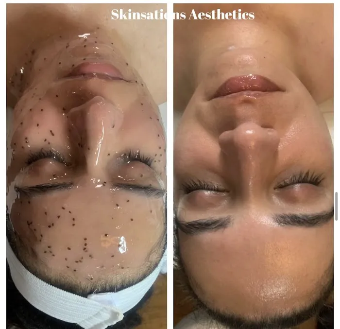 Skinsations Aesthetics Picture 5