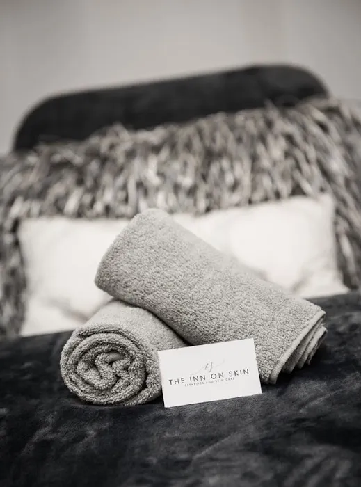 the inn on skin Picture 7