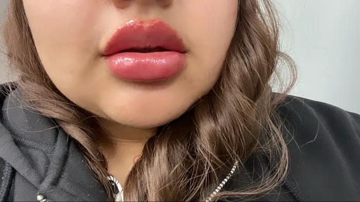 Tox and Lips Picture 2