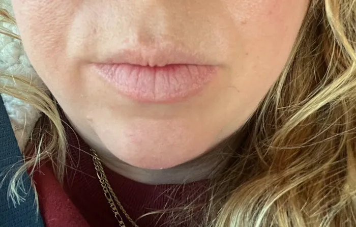 Tox and Lips Picture 4