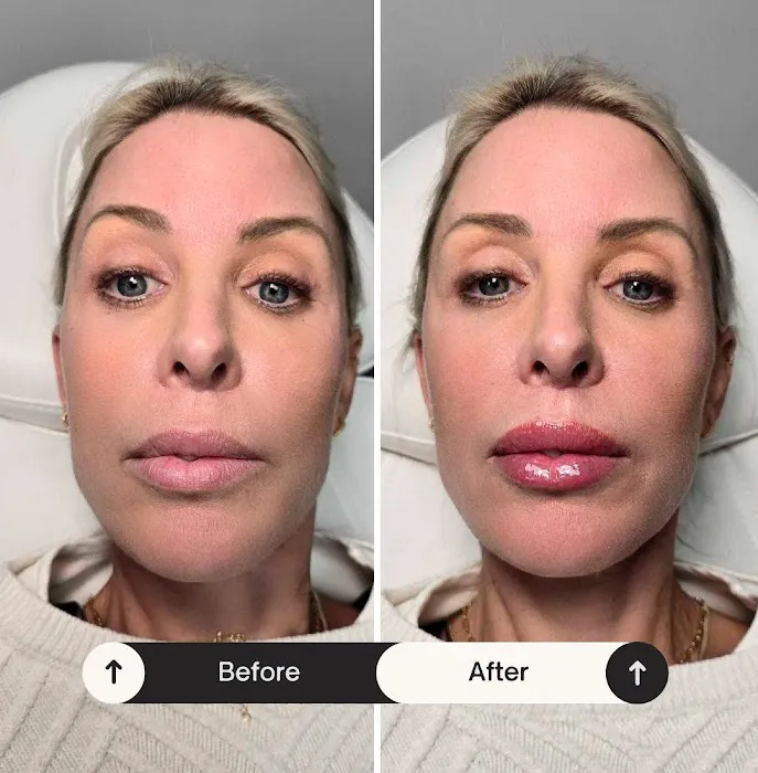 Tox and Lips Picture 6