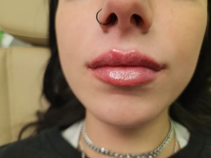 Tox and Lips Picture 5