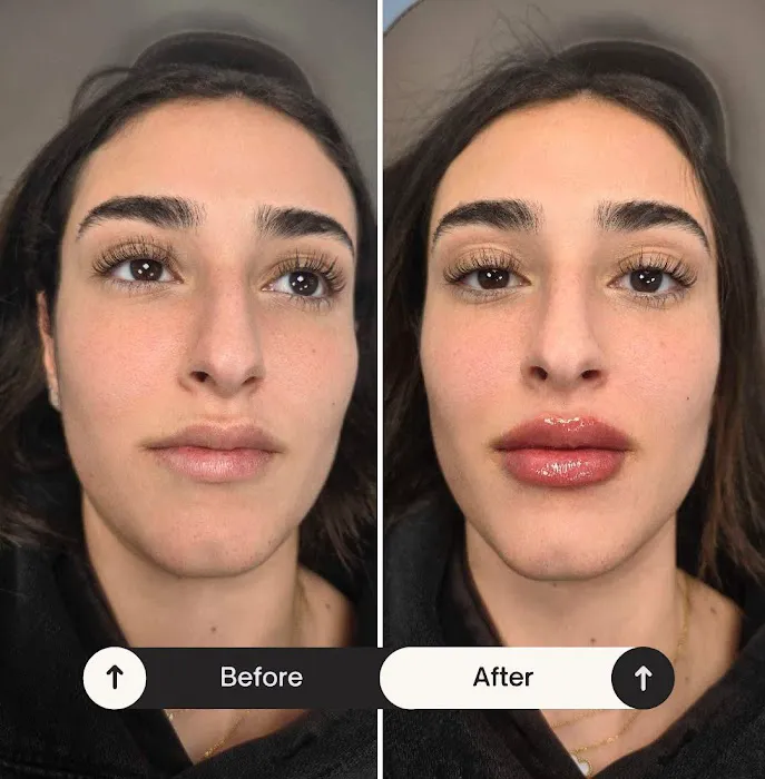 Tox and Lips Picture 10