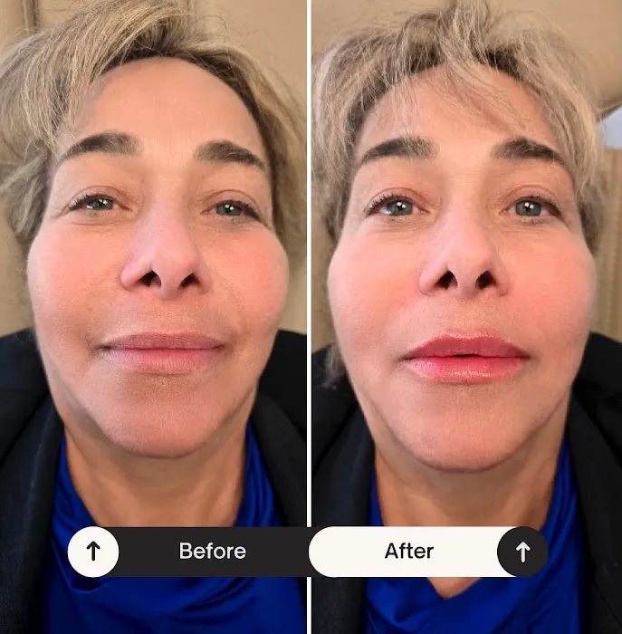 Tox and Lips Picture 9