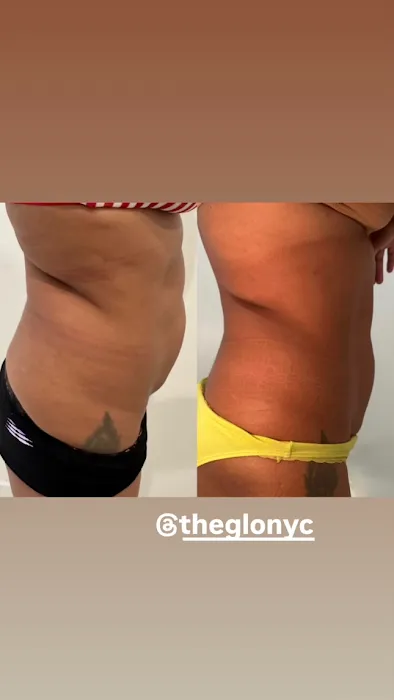 The Glo Skin Tight Laser Club Picture 9