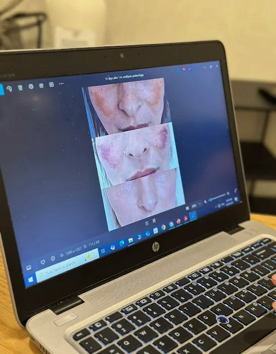 Yumiko cosmetology aesthetic Picture 8