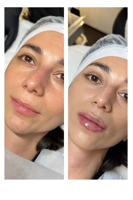 Yumiko cosmetology aesthetic Picture 7