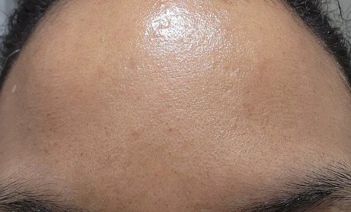 Mahal Skin Treatments Picture 8