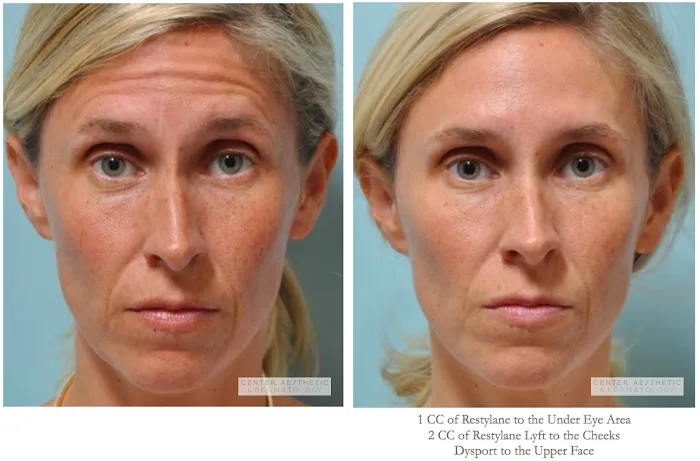 Center Aesthetic & Dermatology Picture 9