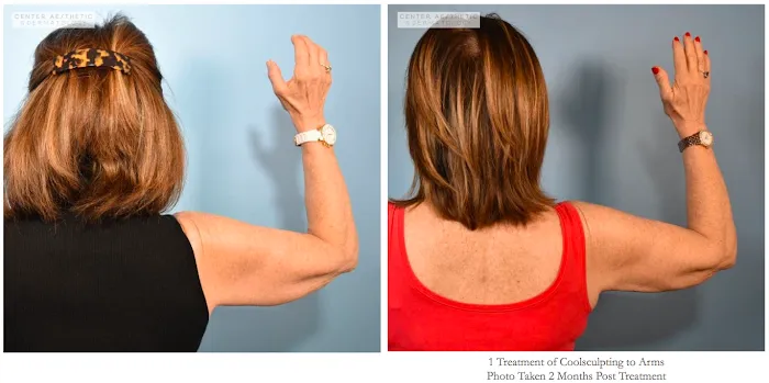 Center Aesthetic & Dermatology Picture 10