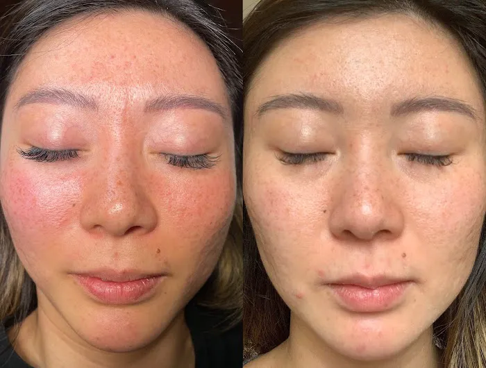 LAZ Skincare Clinic Picture 8