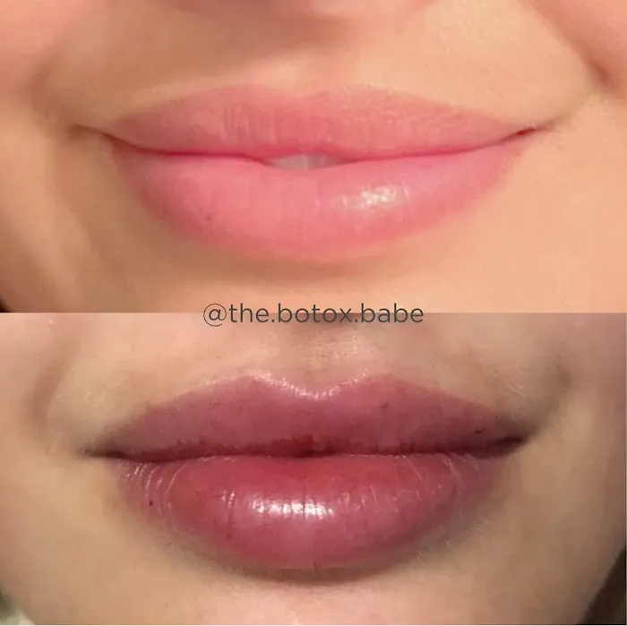 Samantha Fasano, RN Picture 5