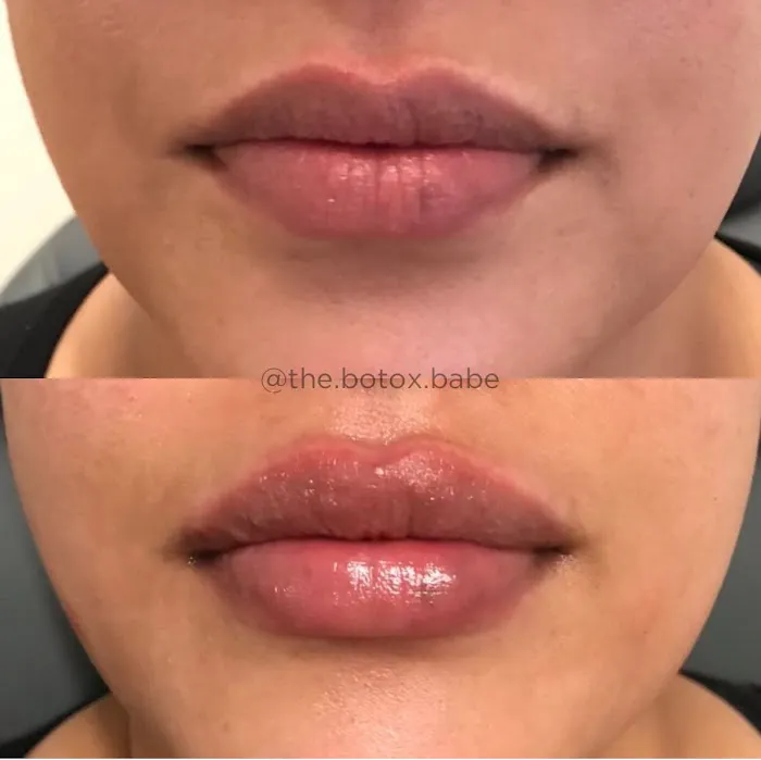 Samantha Fasano, RN Picture 4