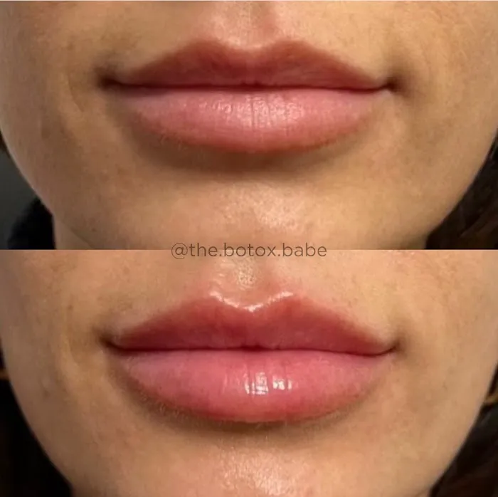 Samantha Fasano, RN Picture 6