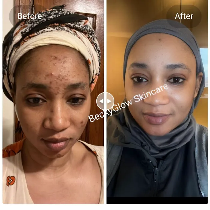 BeckyGlow Skincare LLC Picture 6