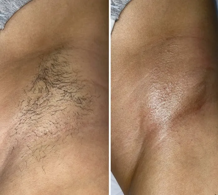 1014 Skin Lounge Picture 1