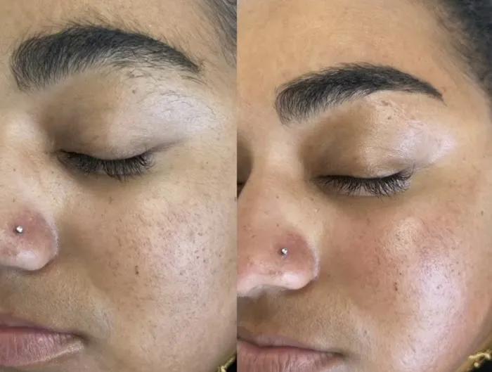 1014 Skin Lounge Picture 5