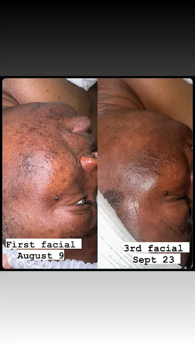 1014 Skin Lounge Picture 7