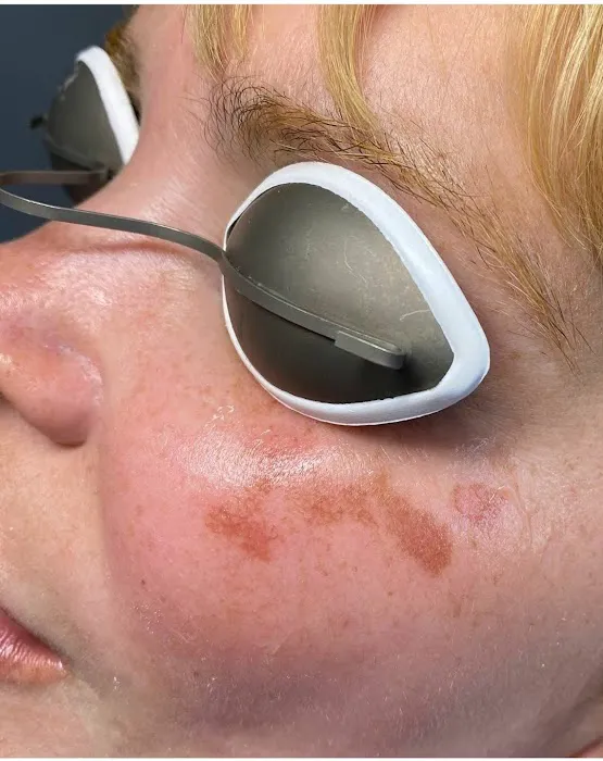 FaBesthetics Face and Body Med Spa Picture 8