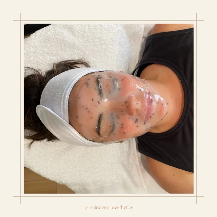 Skindeep Aesthetics Picture 9