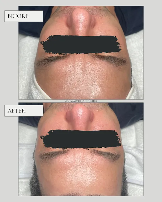 Anna Yoshida Esthetics Picture 3