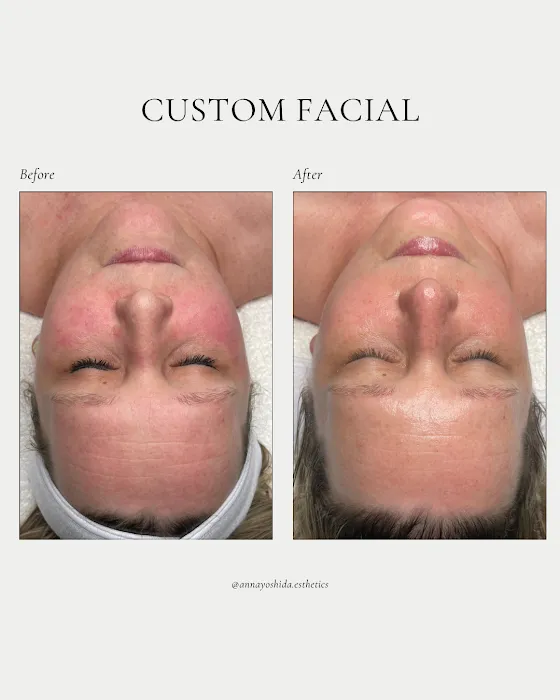 Anna Yoshida Esthetics Picture 4