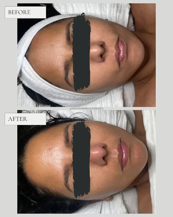 Anna Yoshida Esthetics Picture 6