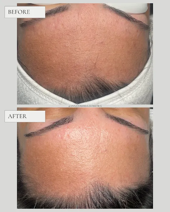 Anna Yoshida Esthetics Picture 5