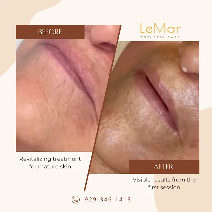 LeMar Esthetic Care Picture 4