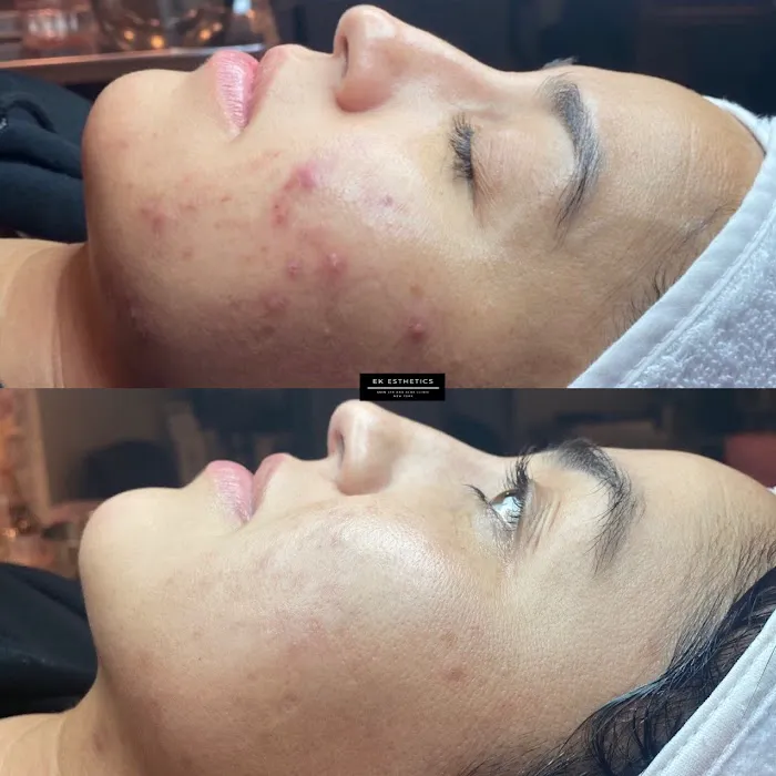 EK ESTHETICS, NEW YORK Picture 8