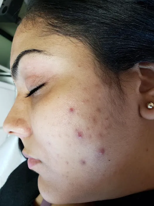 Ny beauty care Picture 1