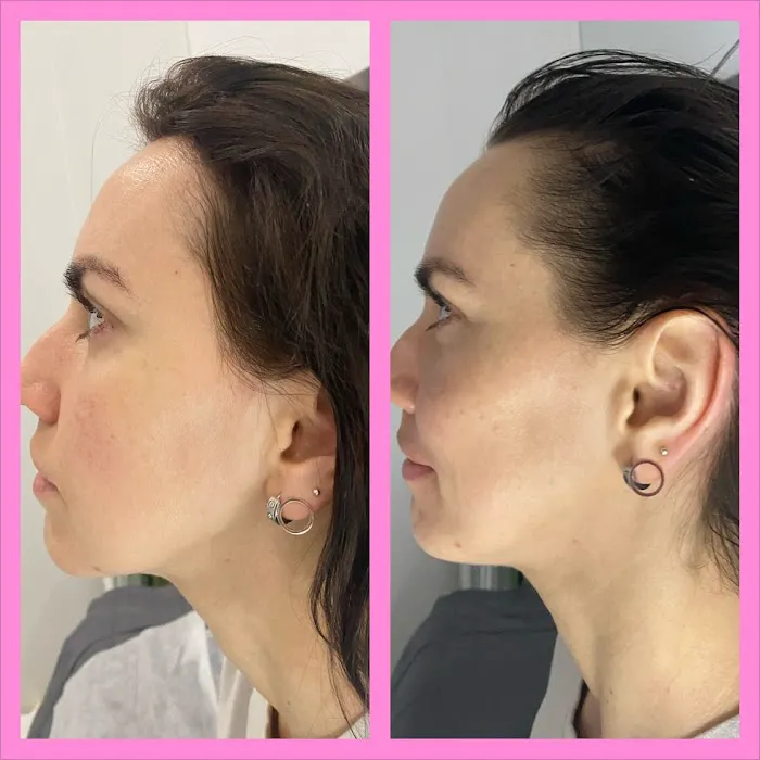 Full Frontal Beauty & Esthetics Picture 7