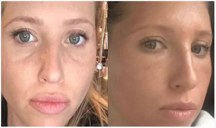 Alinea Medical Spa Acne Scar & Laser Skin Care NYC Picture 7