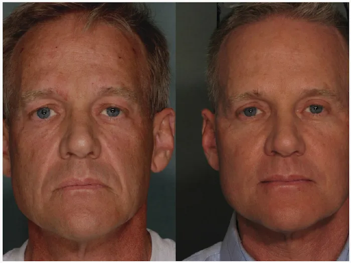 Alinea Medical Spa Acne Scar & Laser Skin Care NYC Picture 9