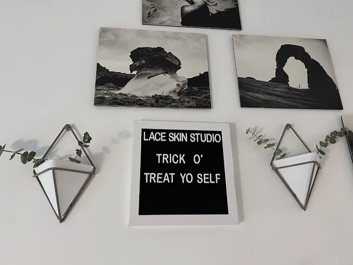 Lace Skin Studio Picture 4