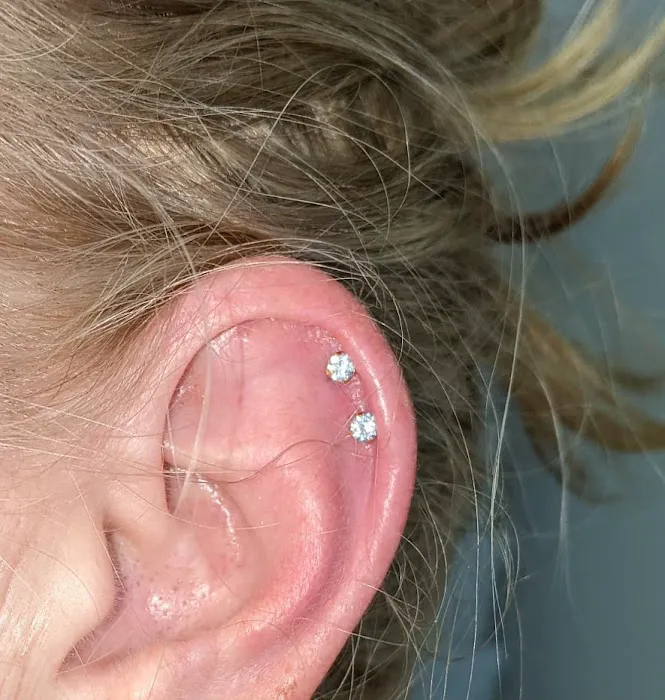 Bare Facts Skin Aesthetics-Facials-Peels-Collagen Induced Therapy-Needling- Electrolysis-Ear Lobe & Helix Piercing. Picture 4