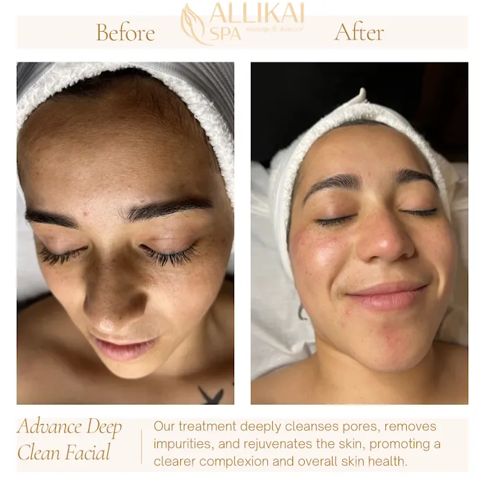 Allikai Spa - Massage & Skincare Picture 5