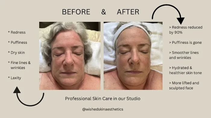 Wished Skin Aesthetics Studio Picture 4