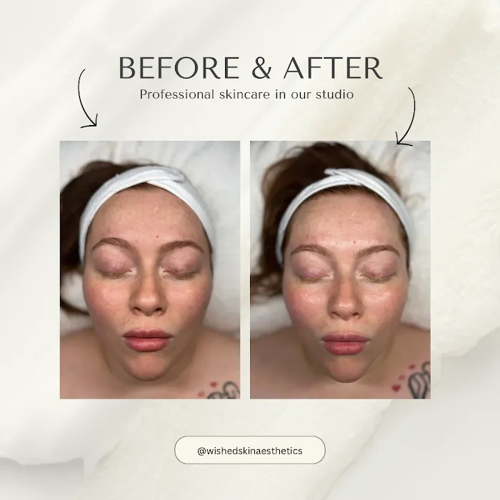 Wished Skin Aesthetics Studio Picture 6