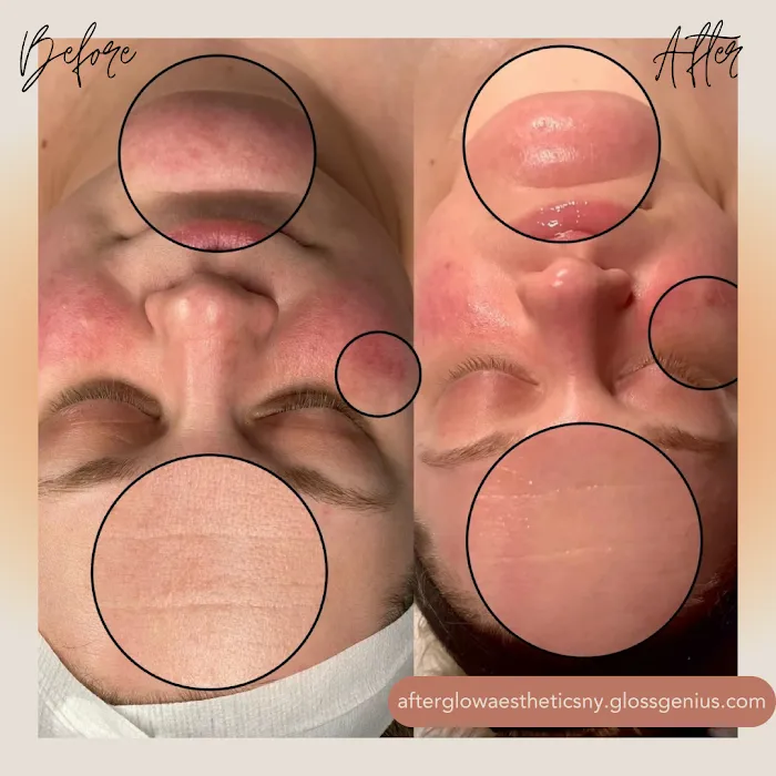 Afterglow Aesthetics, NY Picture 3