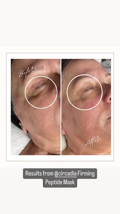 Afterglow Aesthetics, NY Picture 4