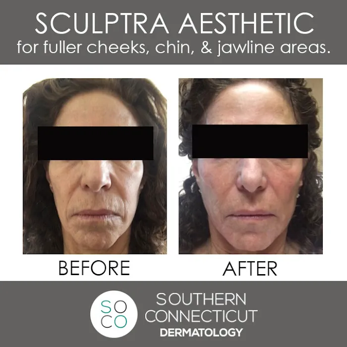 Southern Connecticut Dermatology Picture 9