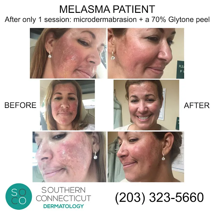 Southern Connecticut Dermatology Picture 7