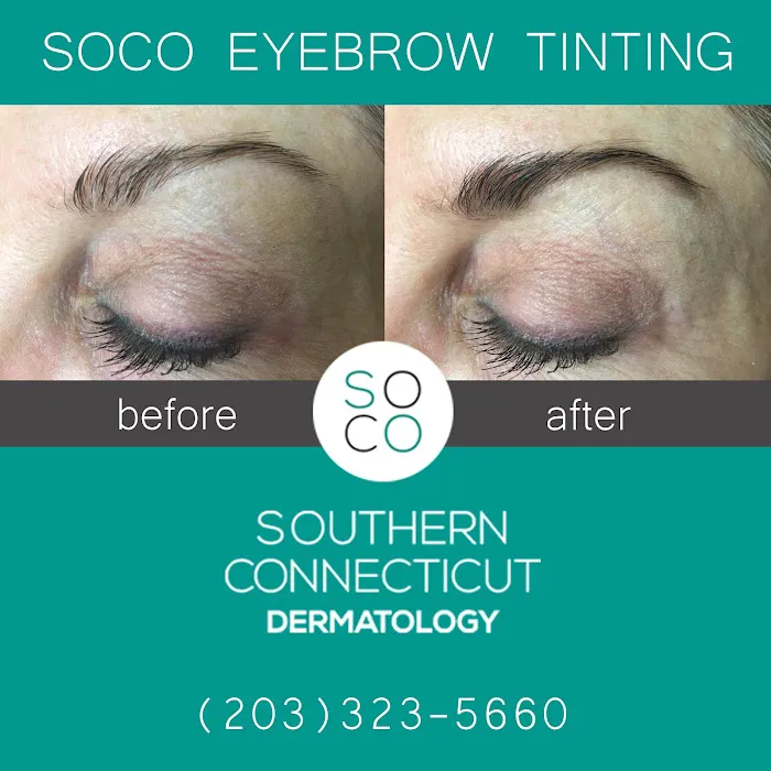 Southern Connecticut Dermatology Picture 8