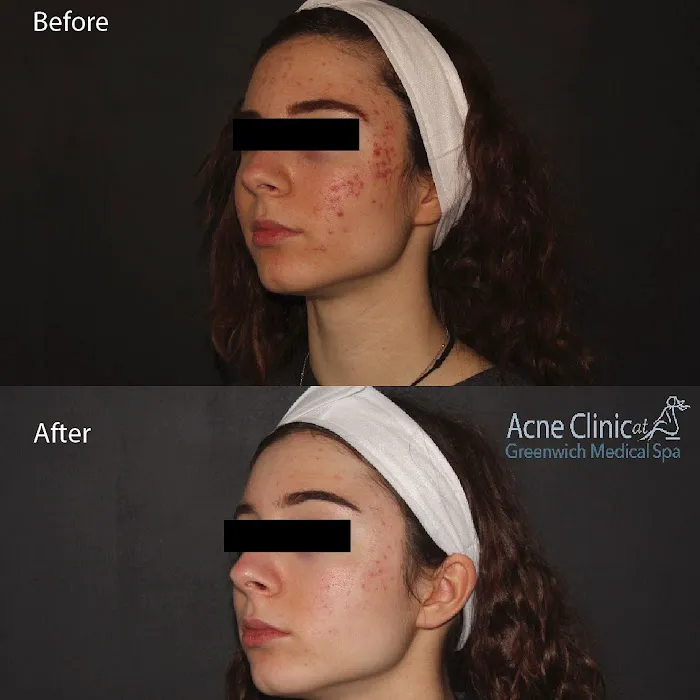 The Acne Clinic at Greenwich Medical Spa Picture 9