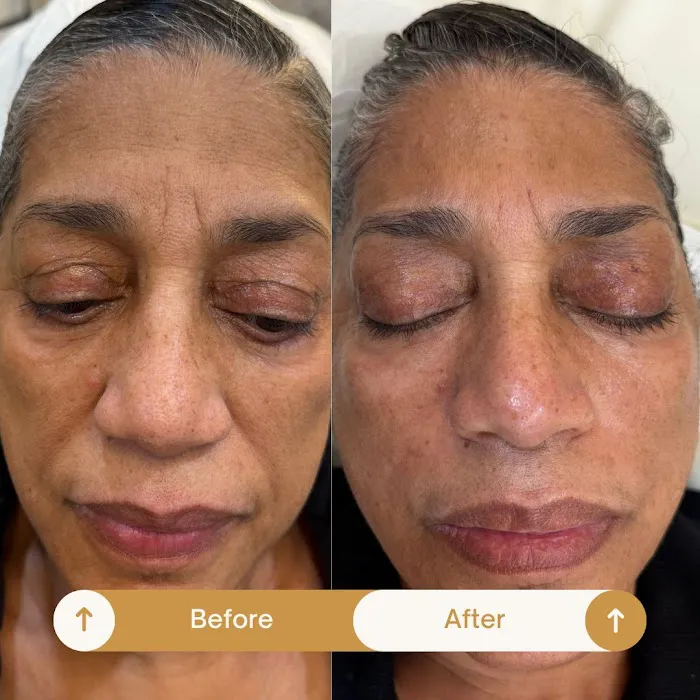 Bellezza Aesthetics NY Picture 4